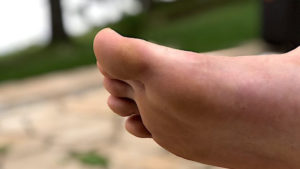 Tips for Calluses in Feet